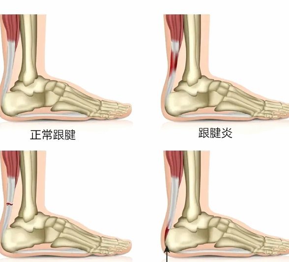 跟队：里沙利松与热刺合同仅剩1年，或合同到期后自由身离队